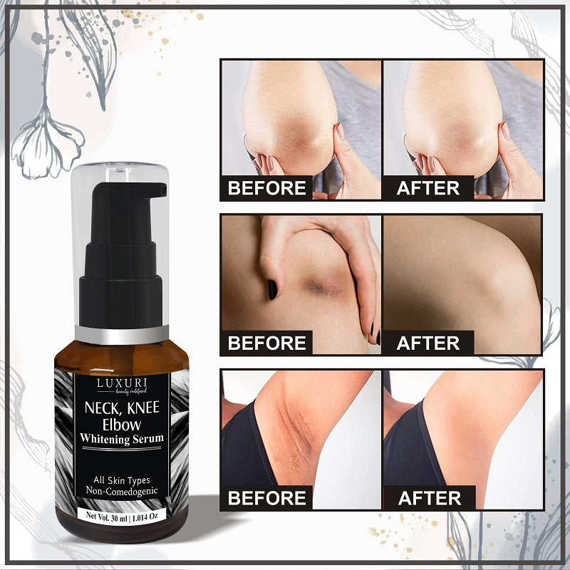 Neck, Knee & Elbow Whitening Serum - 30ml